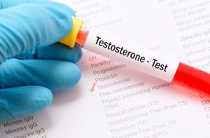 testosterone hormone